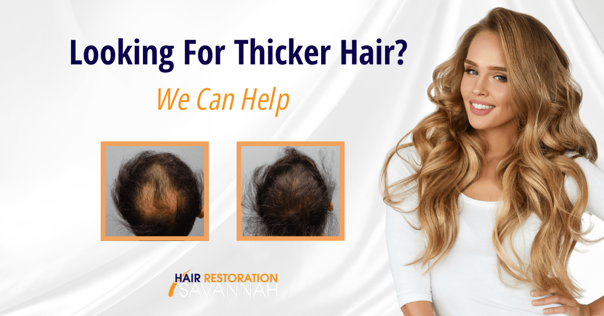 Hair Restoration Savannah Hair Restoration - New youth medical Spa