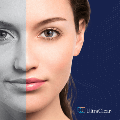 Ultra Clear laser