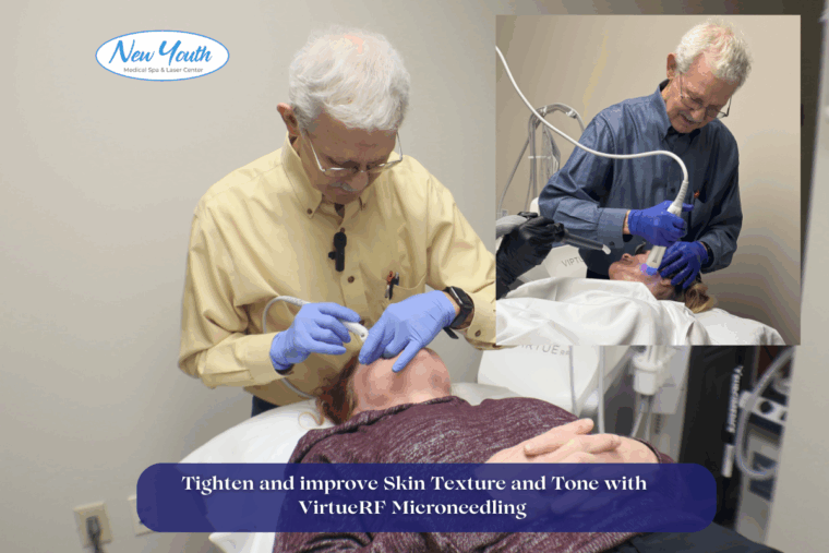 Tighten and improve Skin Texture and Tone with VirtueRF Microneedling