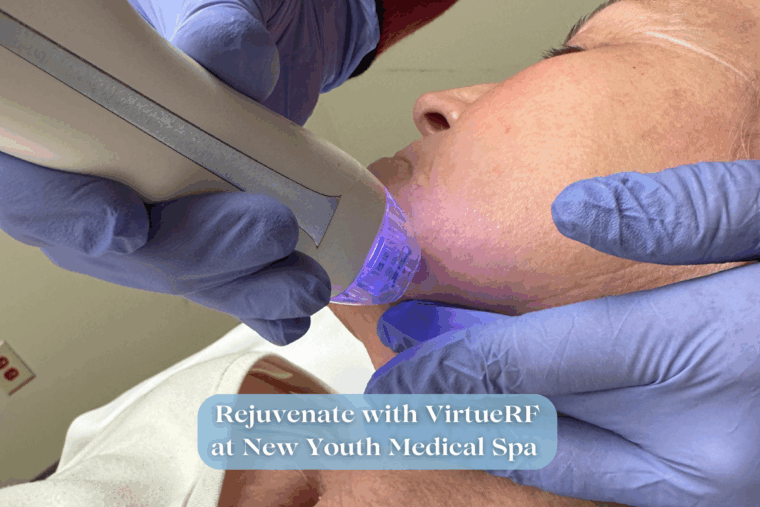 Virtue RF at New Youth Medical Spa Savannah, GA