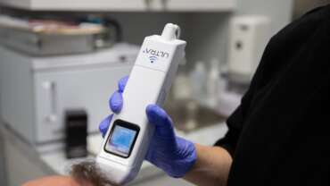 A Modern Needle Free and Pain Free Approach to New Hair Growth