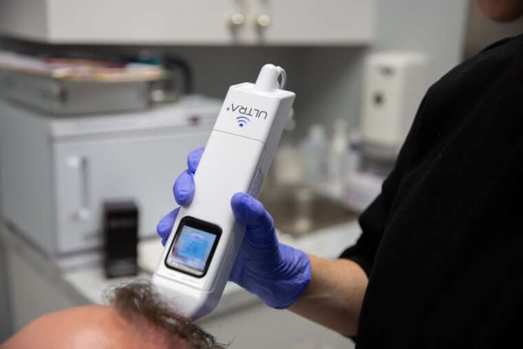 A Modern Needle Free and Pain Free Approach to New Hair Growth