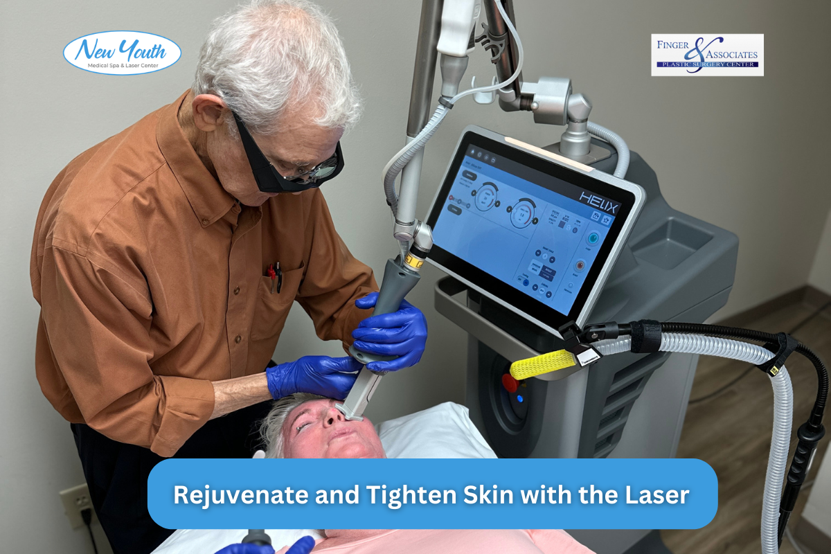 Rejuvenate and Tighten Skin with the Laser At New Youth medical Spa Rejuvenate and Tighten Skin with the Laser At New Youth medical Spa