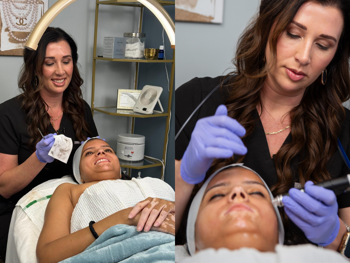 HydraFacial + Dermaplane with Jade at Finger and Associates Savannah , GA HydraFacial + Dermaplane with Jade at Finger and Associates Savannah , GA